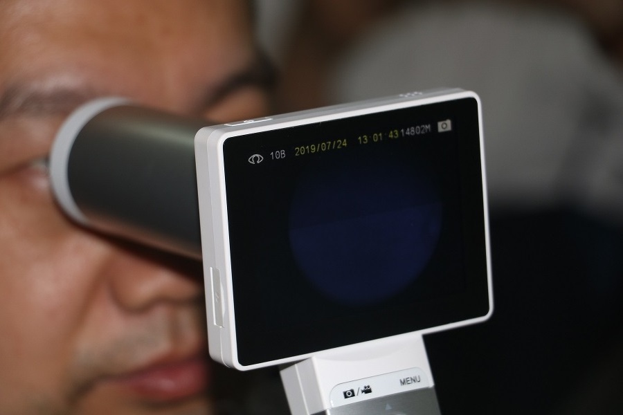 Non-mydriatic Handheld Fundus Camera MiiS Eye Fundus Camera