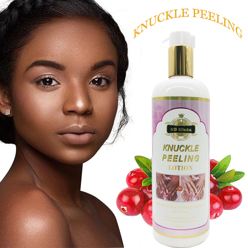 Miracle KNUCKLE PEELING LOTION BEST WHITENING KNUCKLE ELBOW knee skincare product bleaching eclairer skin half cast 500ml