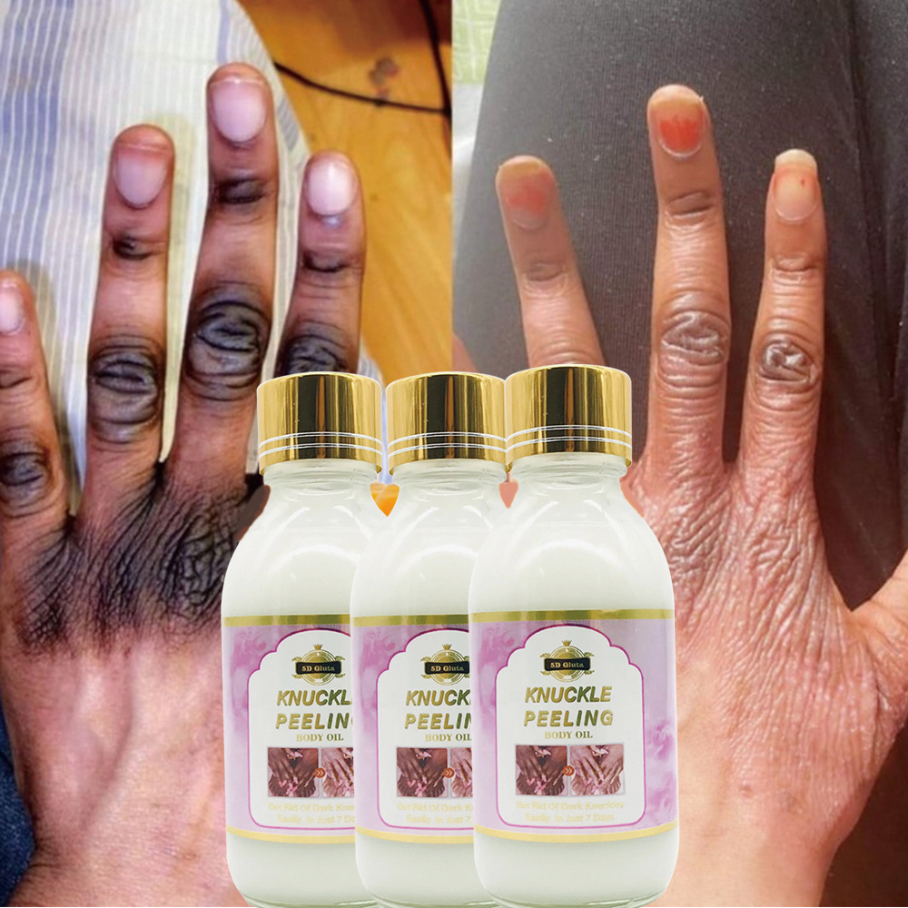 Miracle Knuckle peeling set Exfoliates for dark knuckle, Knee, Elbow Africa skin Fast Whitening Product 7 Days Alpha Arbutin