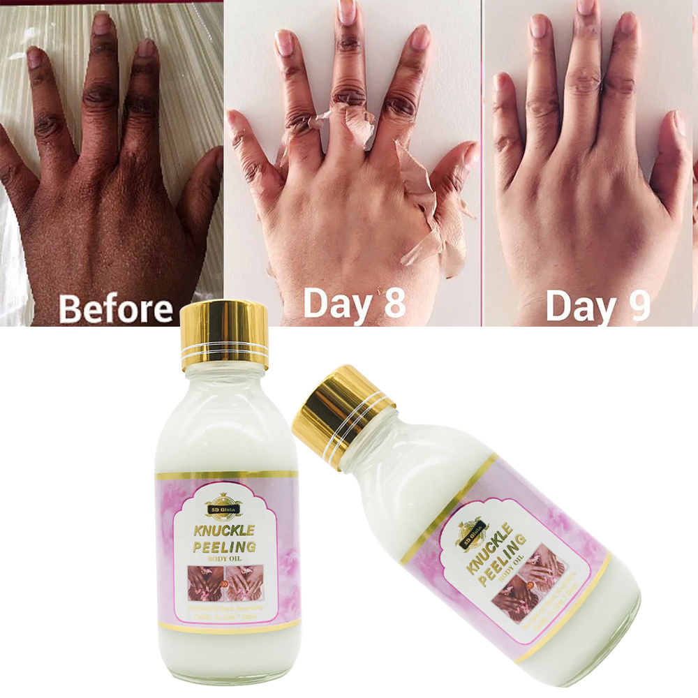 Miracle Knuckle peeling set Exfoliates for dark knuckle, Knee, Elbow Africa skin Fast Whitening Product 7 Days Alpha Arbutin