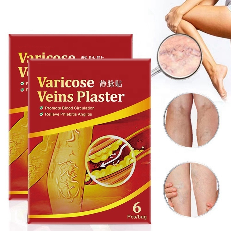 plaster varicose veins treatment blood vessel swelling spider leg vasculitis phlebitis care angiitis patch for women men