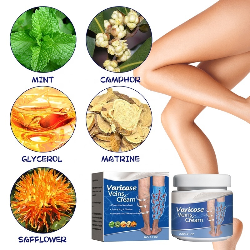 effective body cream for varicose vein treatment remover cream body care chinese herbal repair skin pain relief private label