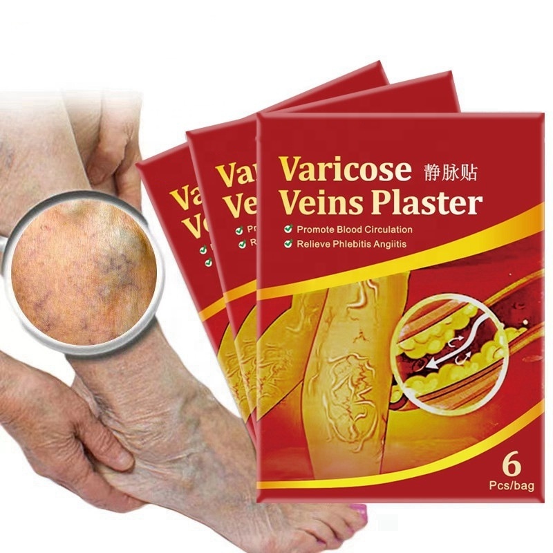 plaster varicose veins treatment blood vessel swelling spider leg vasculitis phlebitis care angiitis patch for women men