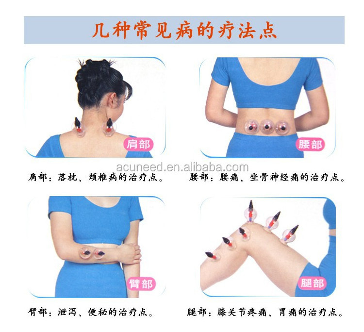 Chinese Traditional Medical Plastic Vacuum Therapy Cupping Set 8pcs/box