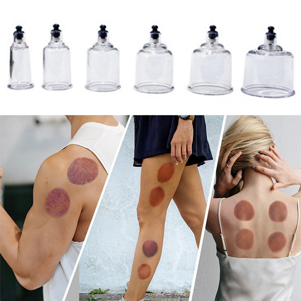 12 Cupping Cups Household Pull Out Vacuum Cupping Kit Traditional Chinese Therapy Cupping Set