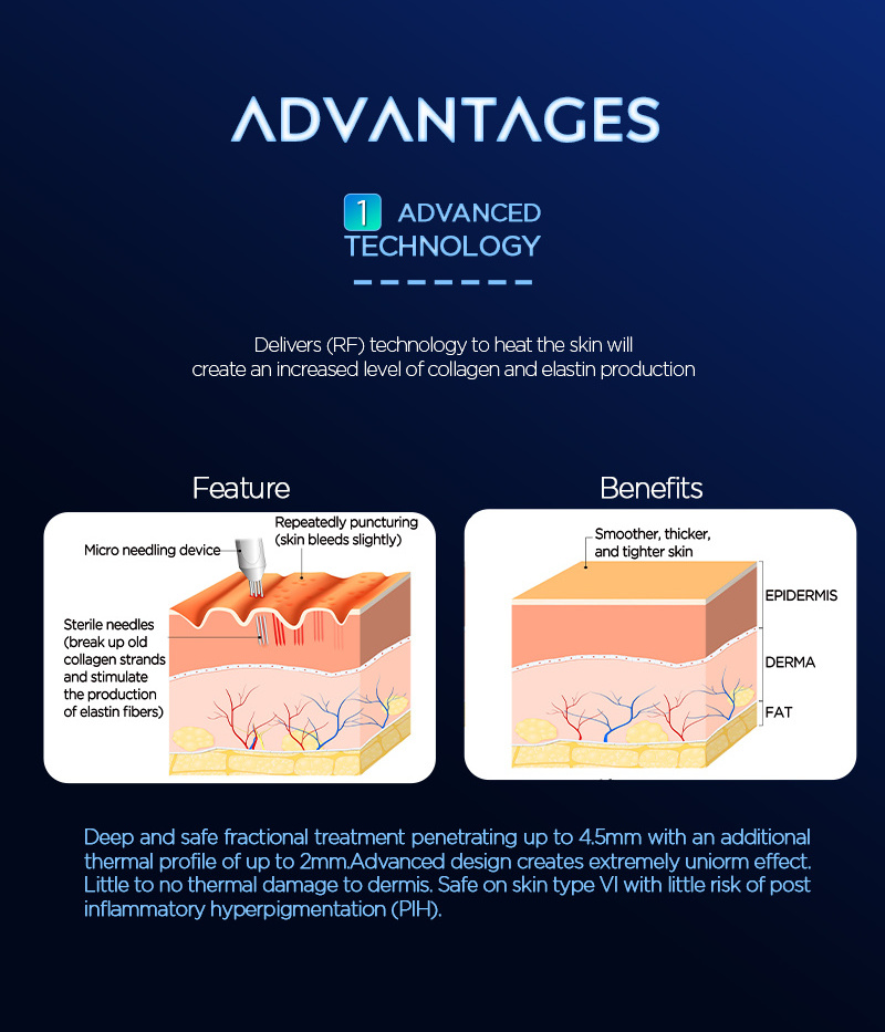 ADSS Gold Morpheus 8 Microneedle  RF Microneedling Machine for Skin Tightening