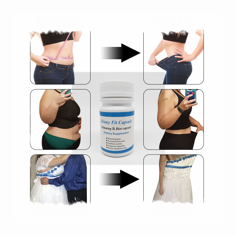 New 2023 Products Skinny Fit Capsule Reduce Weight and Decline the Fat Suppress Appetite Slimming capsules