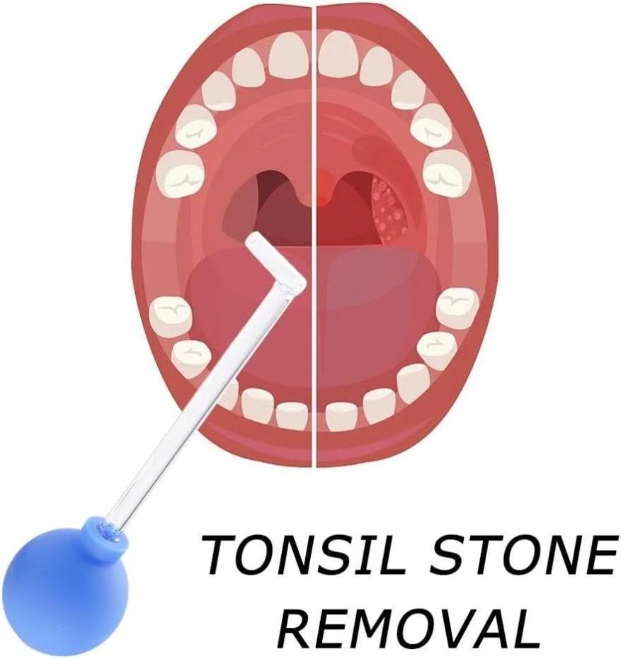 Glass  Removing Tonsil Stones Remove Almond Stones e Mouth Cleaner Remover Tool