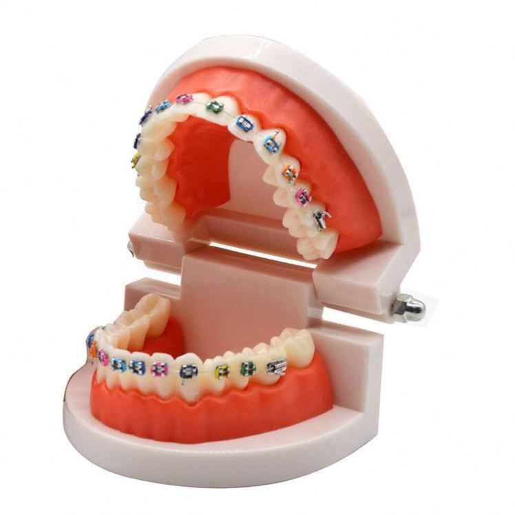 Dental Demonstration Orthodontic Model with Metal Wires and Bracket ...