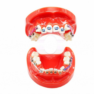 Dental Demonstration Orthodontic Model with Metal Wires and Bracket