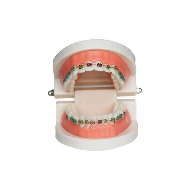 Dental Demonstration Orthodontic Model with Metal Wires and Bracket ...
