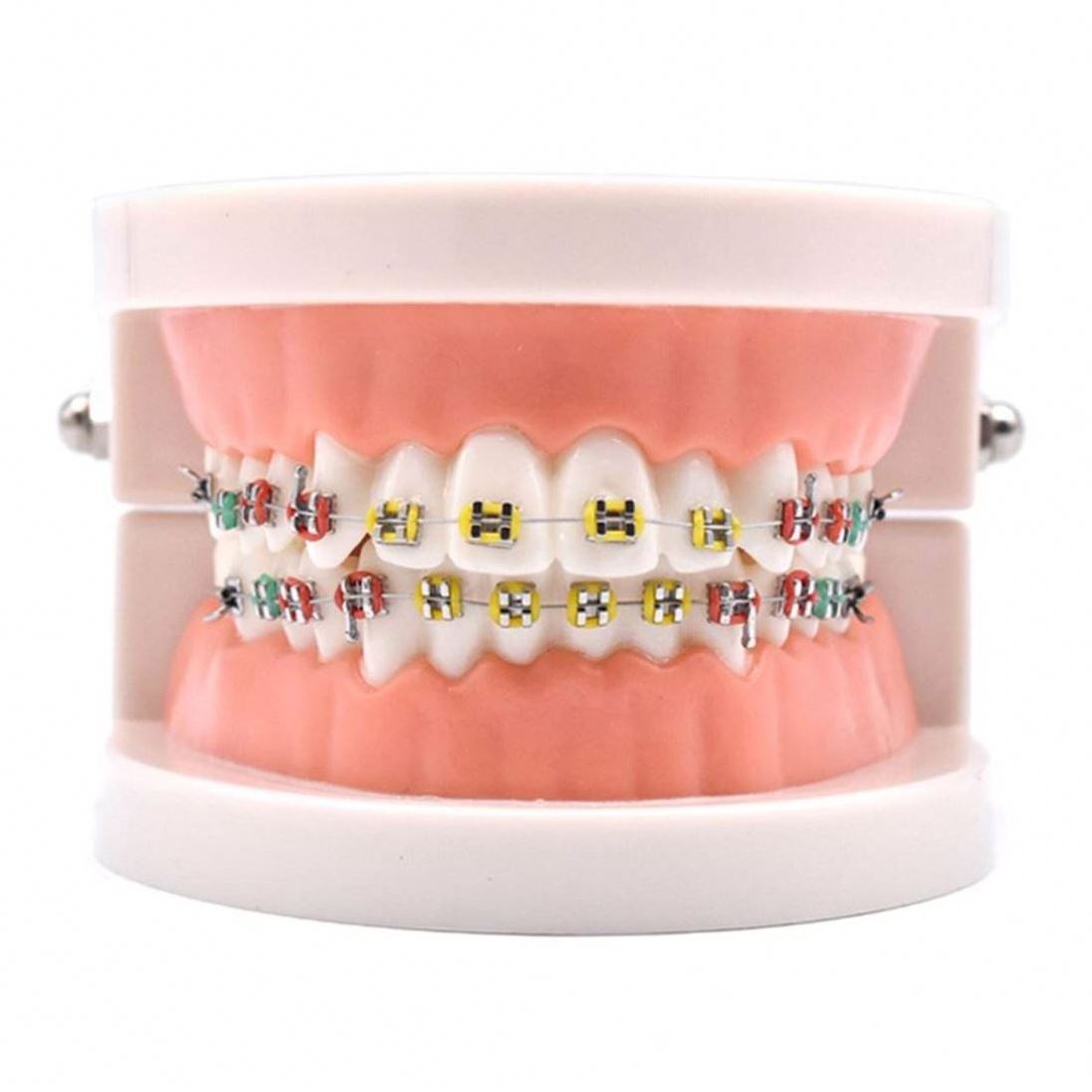 Dental Demonstration Orthodontic Model with Metal Wires and Bracket ...