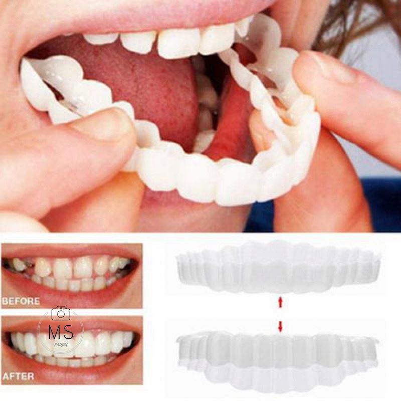 Popular Snap smile customized Perfect Smile teeth Upper lower False teeth cover Denture socket on sale