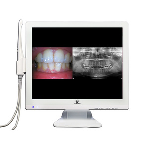 A3M-X dental xray film x-ray film reader and intraoral camera supply portable dental unit