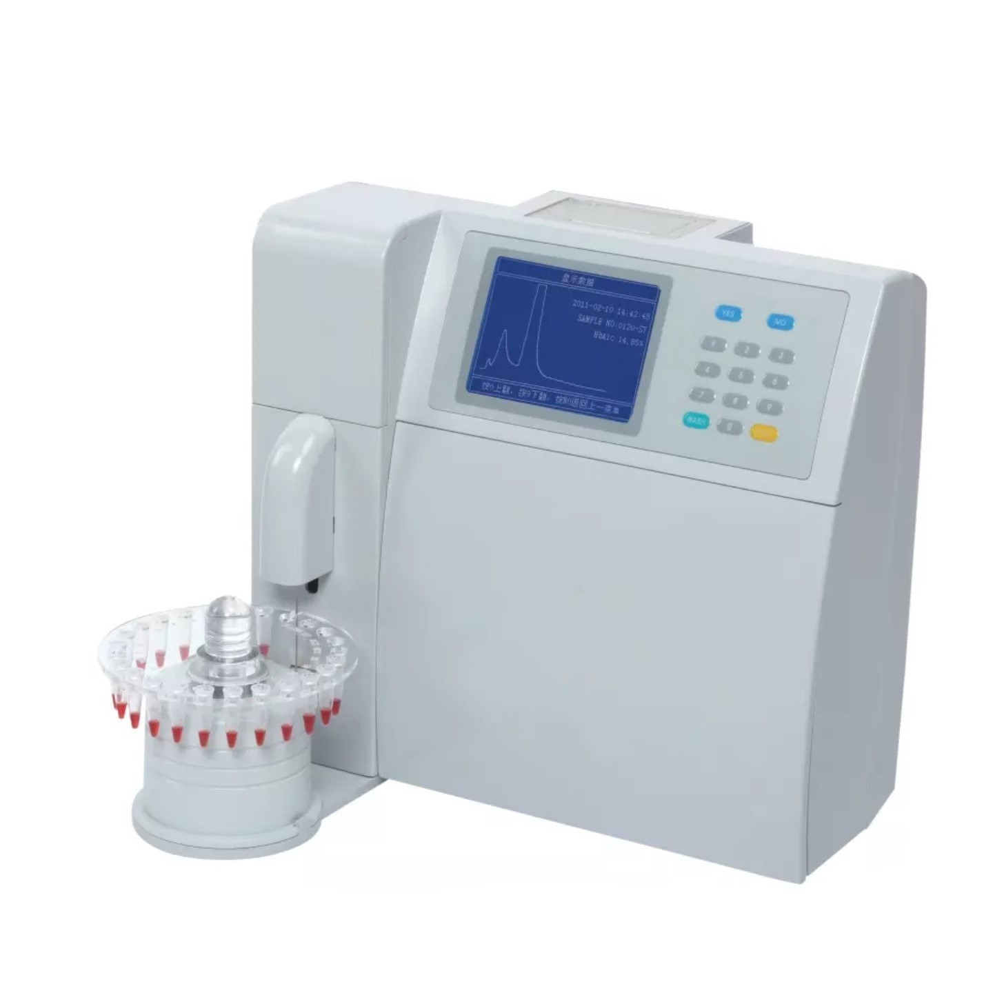 hba1c emoglobin hplc analyzer AC6601 blood glycated hemoglobin hba1c analyzer