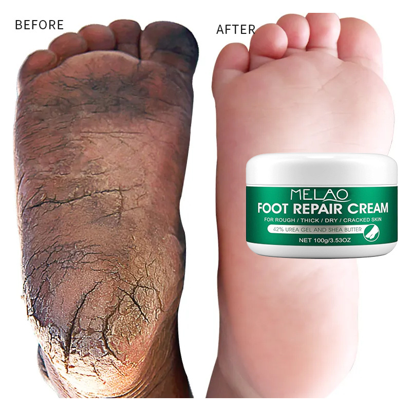 Hands & Feet Care Urea Feet Cream Kids Adults Moisturizing Whitening Foot Cream Anti Odor Foot Hand Repair For Dry Cracked Heels