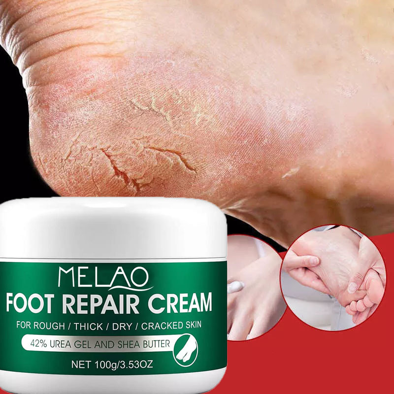 Hands & Feet Care Urea Feet Cream Kids Adults Moisturizing Whitening Foot Cream Anti Odor Foot Hand Repair For Dry Cracked Heels