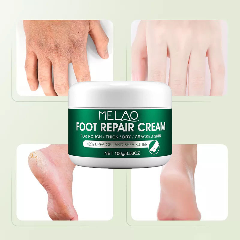 Hands & Feet Care Urea Feet Cream Kids Adults Moisturizing Whitening Foot Cream Anti Odor Foot Hand Repair For Dry Cracked Heels