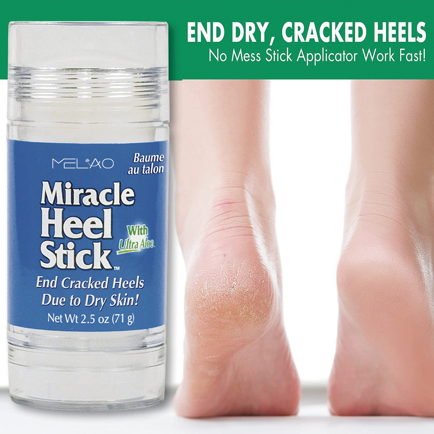 Customize Foot Repair Cracked Heel Repair Foot Balm Antifungal Foot Balm Stick