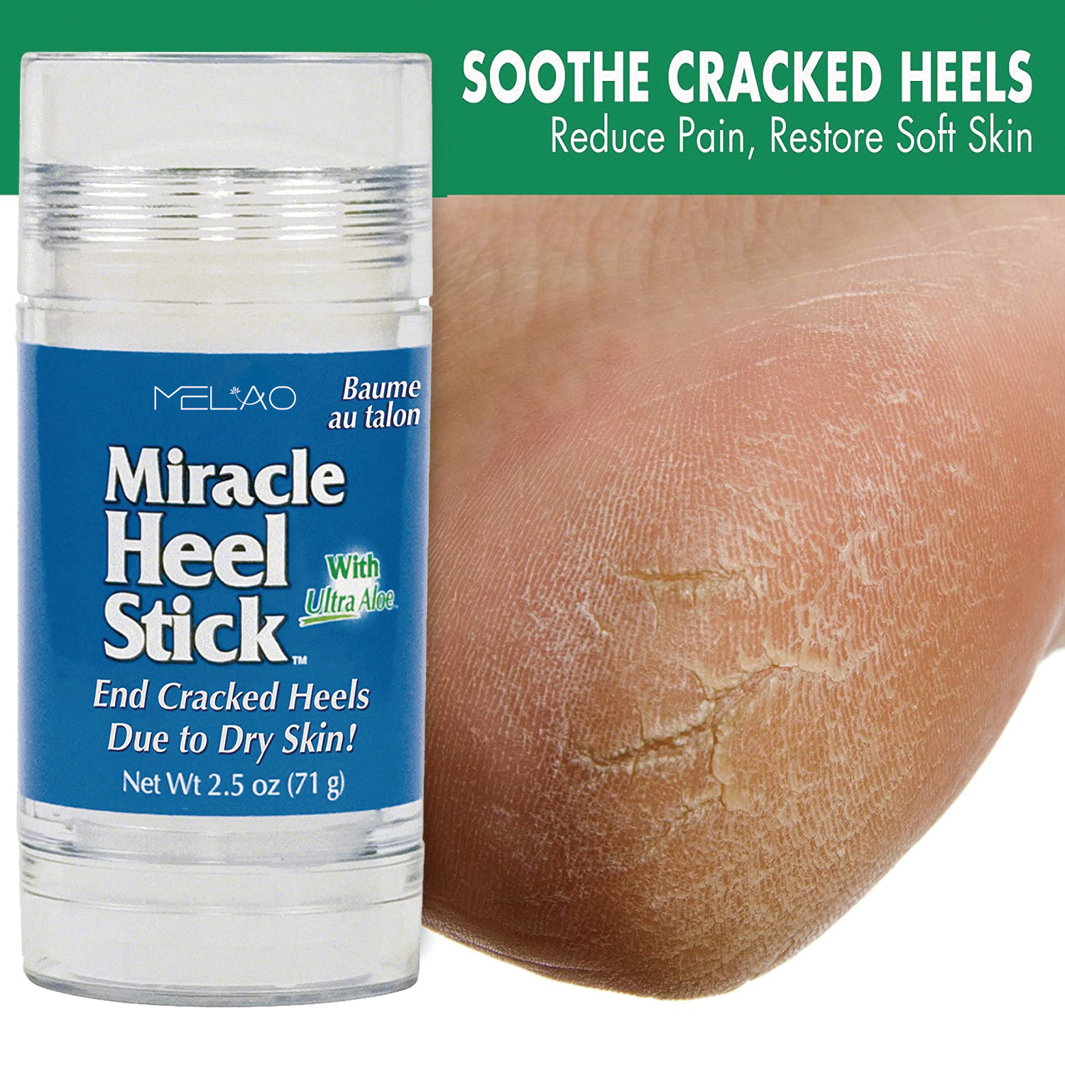 Customize Foot Repair Cracked Heel Repair Foot Balm Antifungal Foot Balm Stick