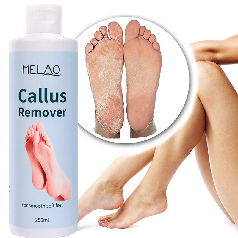 Private Label Whitening Foot Exfoliation Remover Dead Skin Eliminator moisturizing anti inflammatory Foot Exfoliator Gel