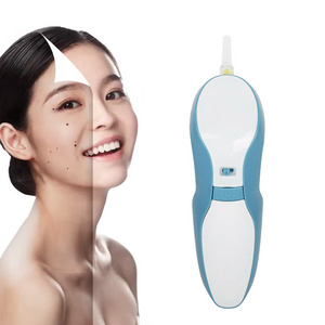 Laser and skin tag pen for mole removal can effectplasma pen wrinkle removal skin tighenting lifting facial plasma pen