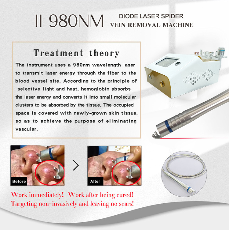 New Product Launch 980nm 5+1 Diode Laser Machine 980nm Diode Laser Vascular Removal For Beauty Salon Machine