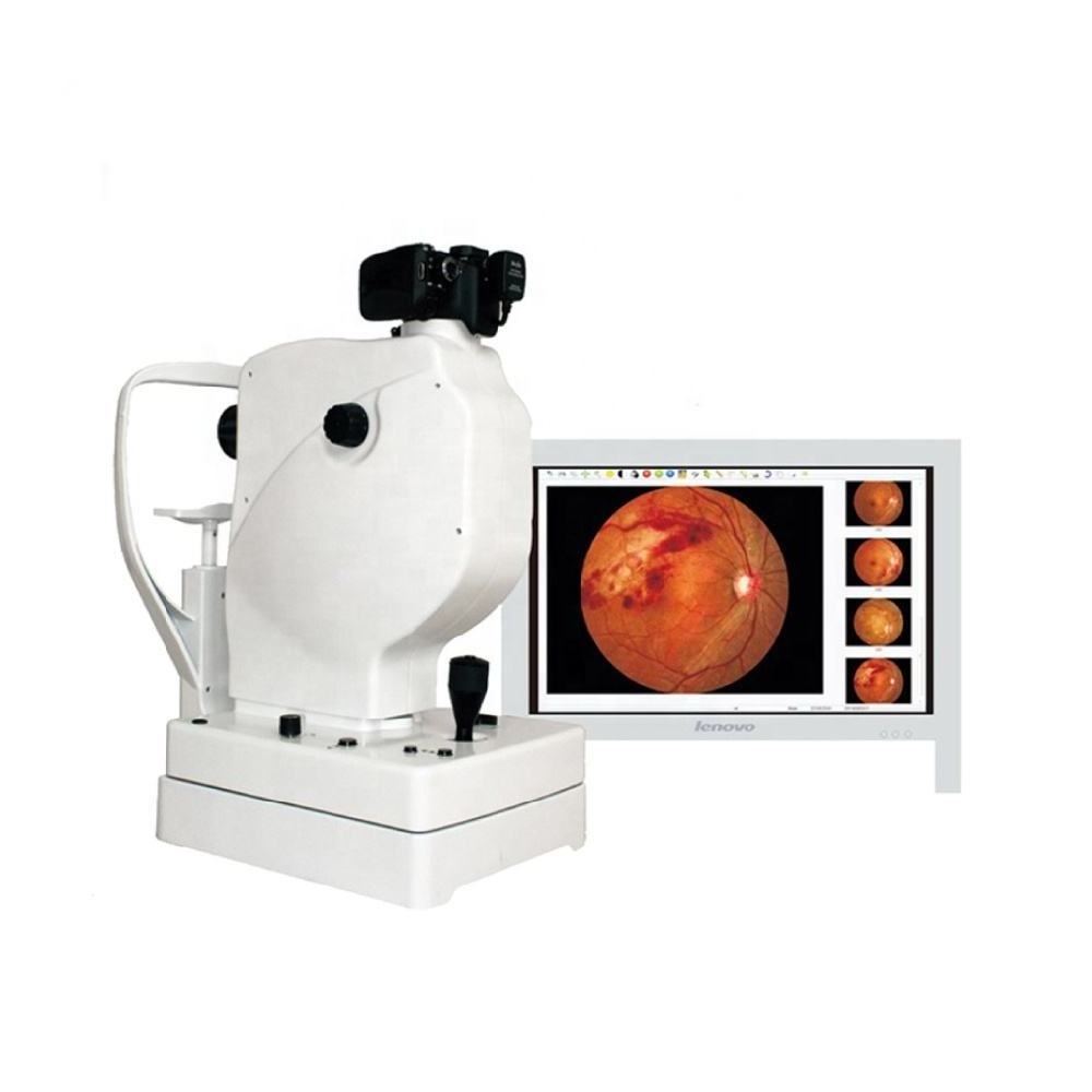 Auto digital eye Retinal ophthalmic Non-mydriatic fundus camera SK-650A