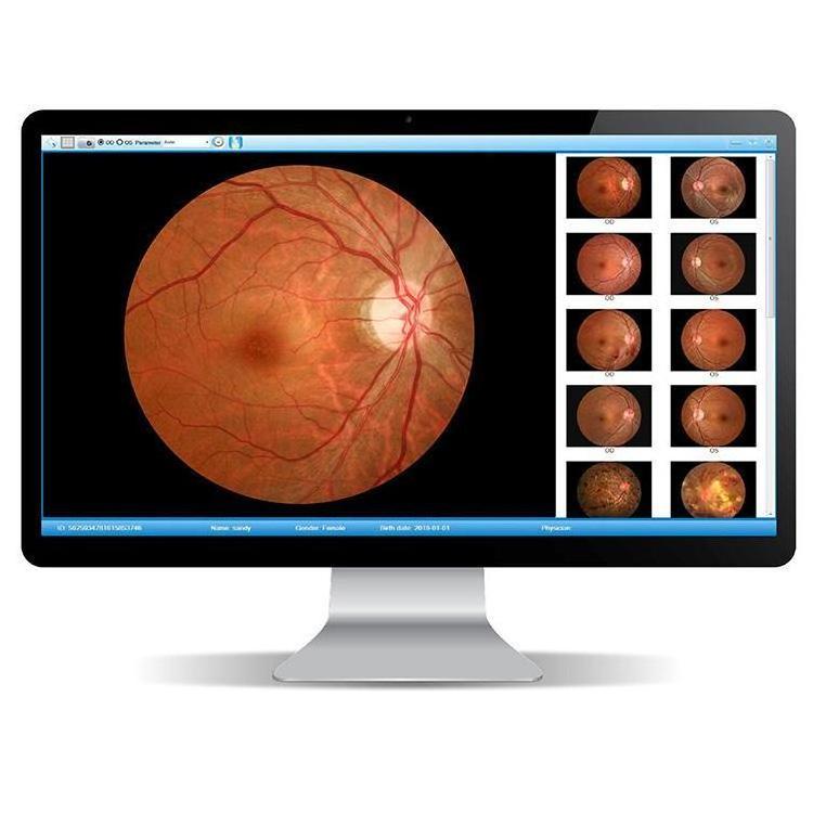 Auto digital eye Retinal ophthalmic Non-mydriatic fundus camera SK-650A