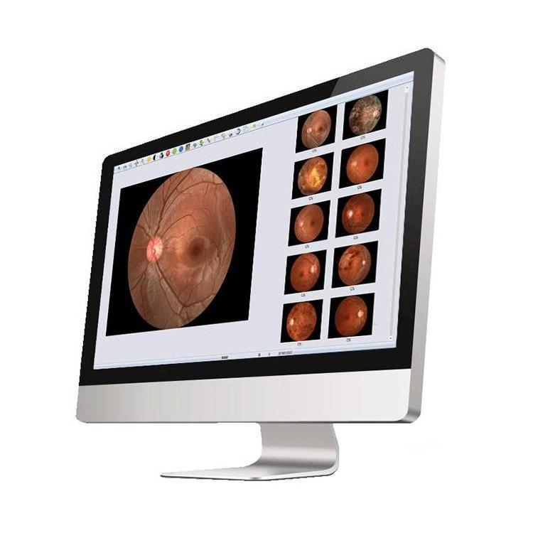 Auto digital eye Retinal ophthalmic Non-mydriatic fundus camera SK-650A