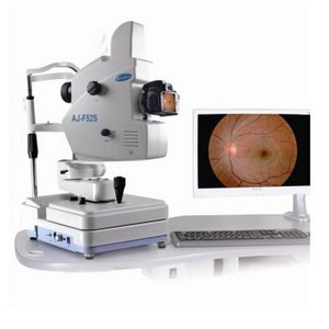 Ophthalmic Automated Digital Eye Fundus Camera Non-mydriatic Faf Ffa Retinal Fundus Imaging