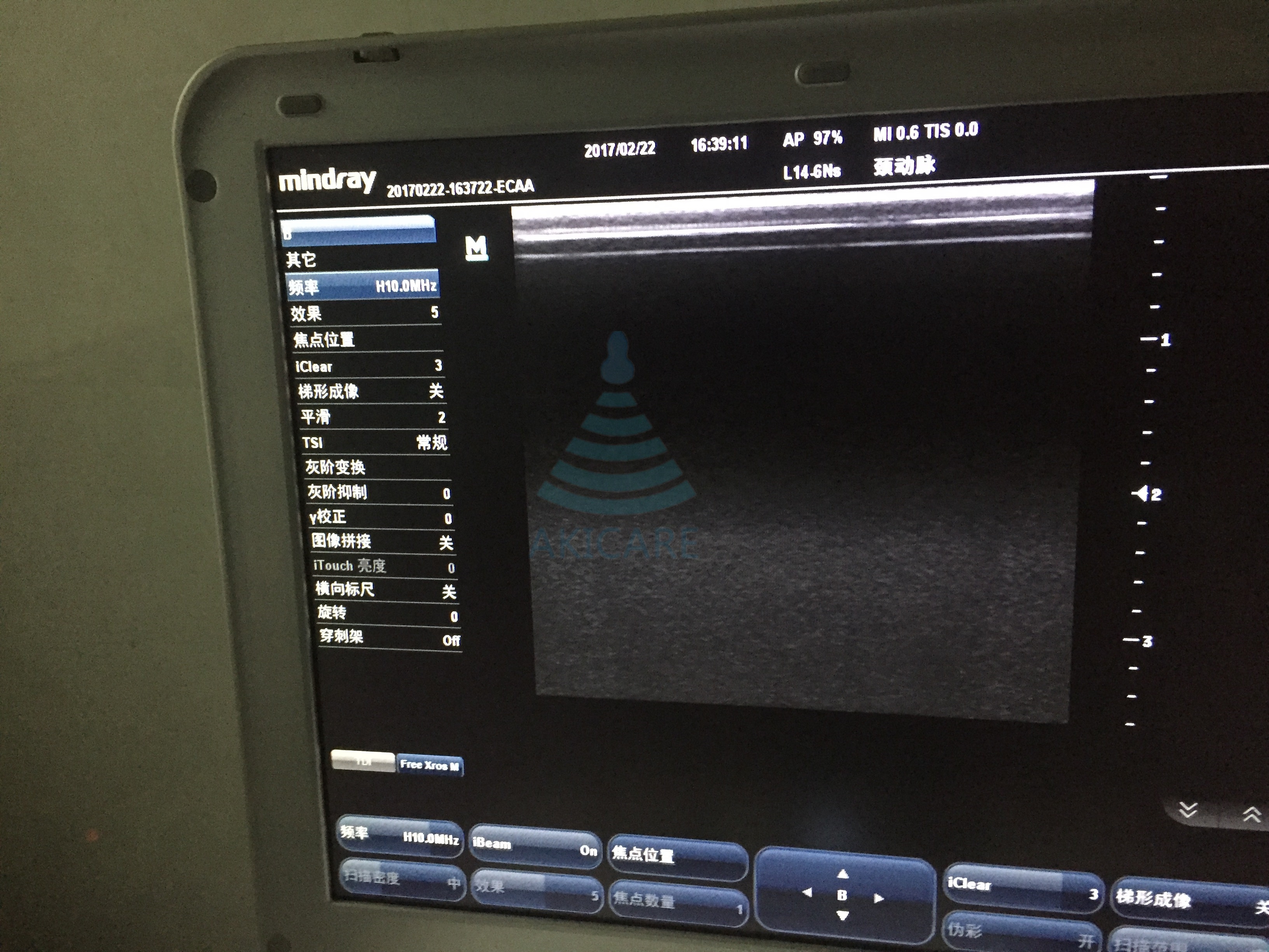 L14-6Ns For Mindray M7 M9 TE7 New Compatible Linear Array 6-14 Mhz High Frequency Ultrasonic Transducer Ultrasound Probe