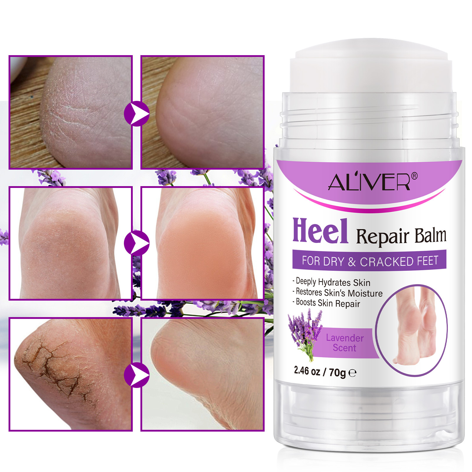 ALIVER Natural Organic Foot Care Heel Repair Cream Intensive Moisturizing Anti Crack Peeling Dead Skin Removal Heel Repair Balm