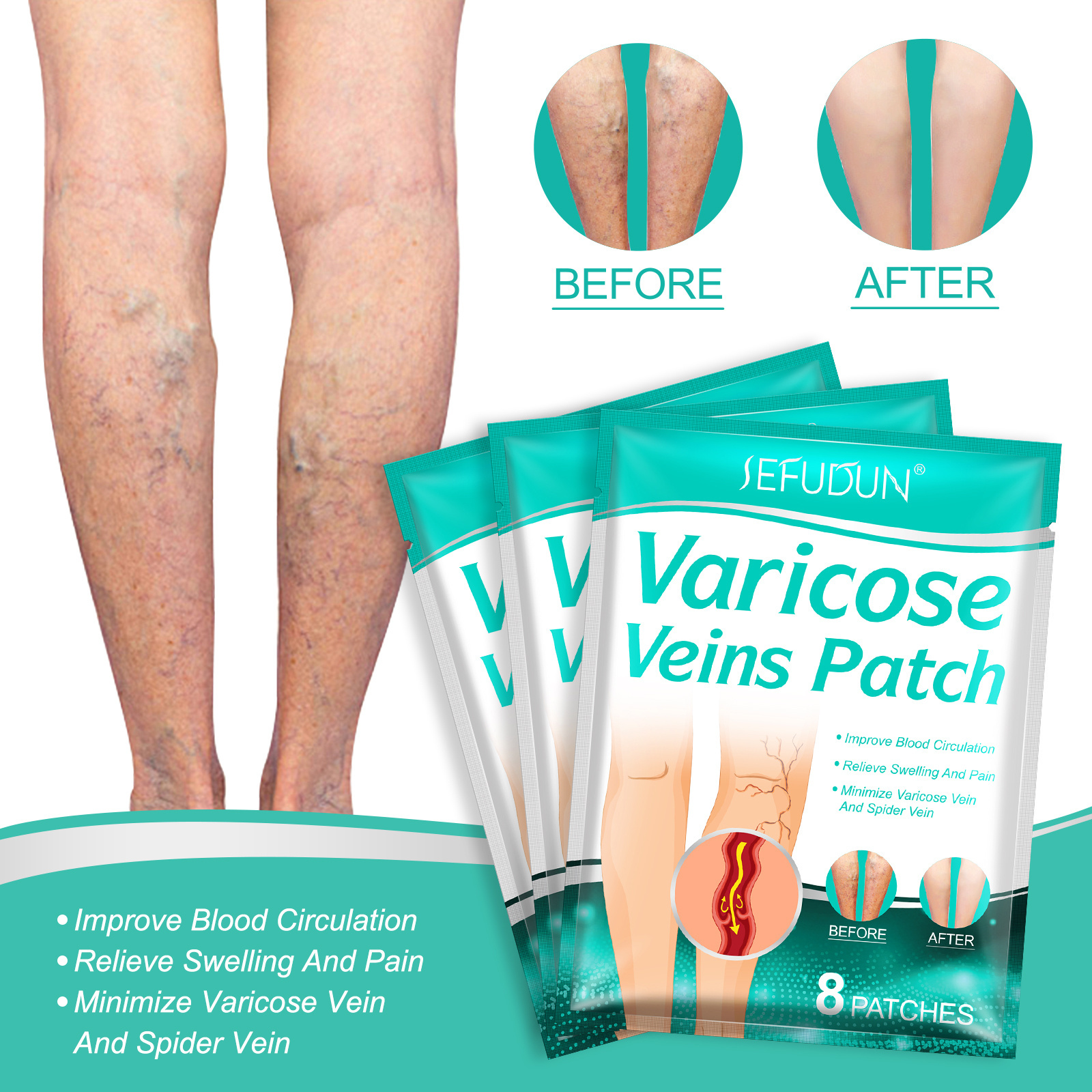 OEM Herbal Health Care Varicose Veins Treatment Patch Improve Blood Circulation Relieve Swelling Pain Varicose Medical Patch