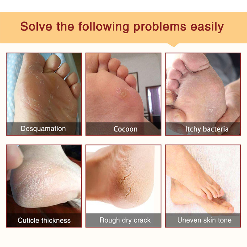 Repair Foot Skin Exfoliator Peel Off Calluses Dead Skin Callus Remover Baby Soft Smooth Touch Feet-Men Women Foot Peel Mask