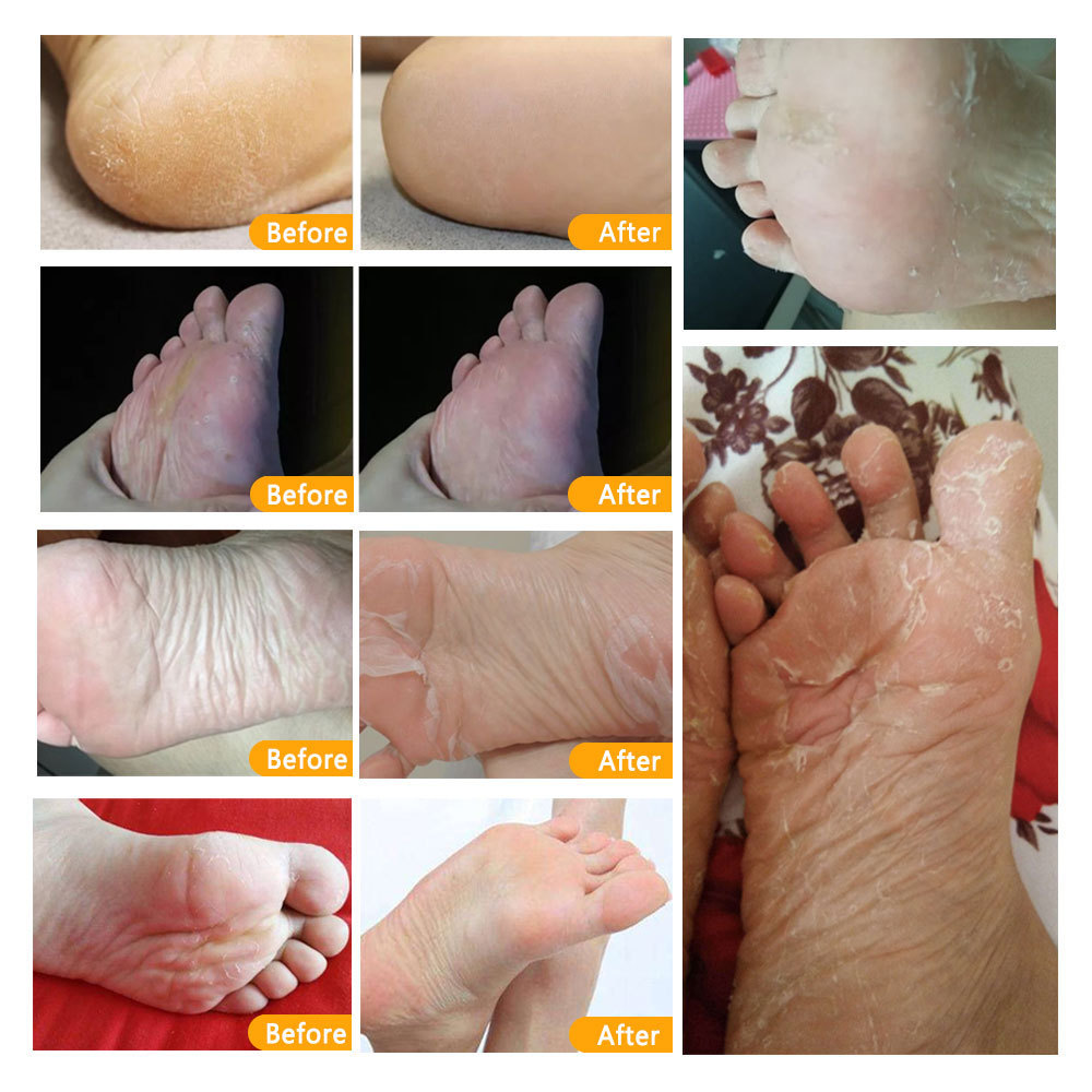 Private Label Organic Moisturizing Repair Soften Cracked Socks Feet Mask Skin Care Product Ginseng Foot Mask