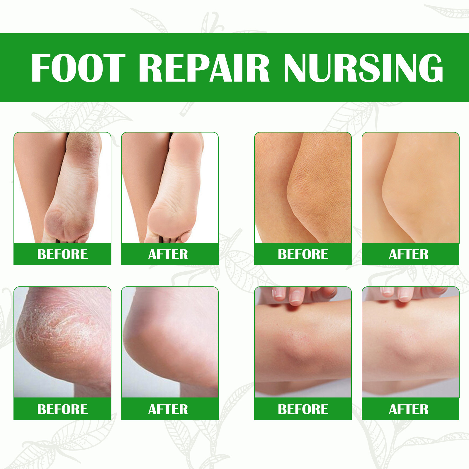 High Quality Feet Care Foot Callus Removal Peeling Spray Moisturizing Nourishing Exfoliating Green Tea Instant Foot Peel Spray