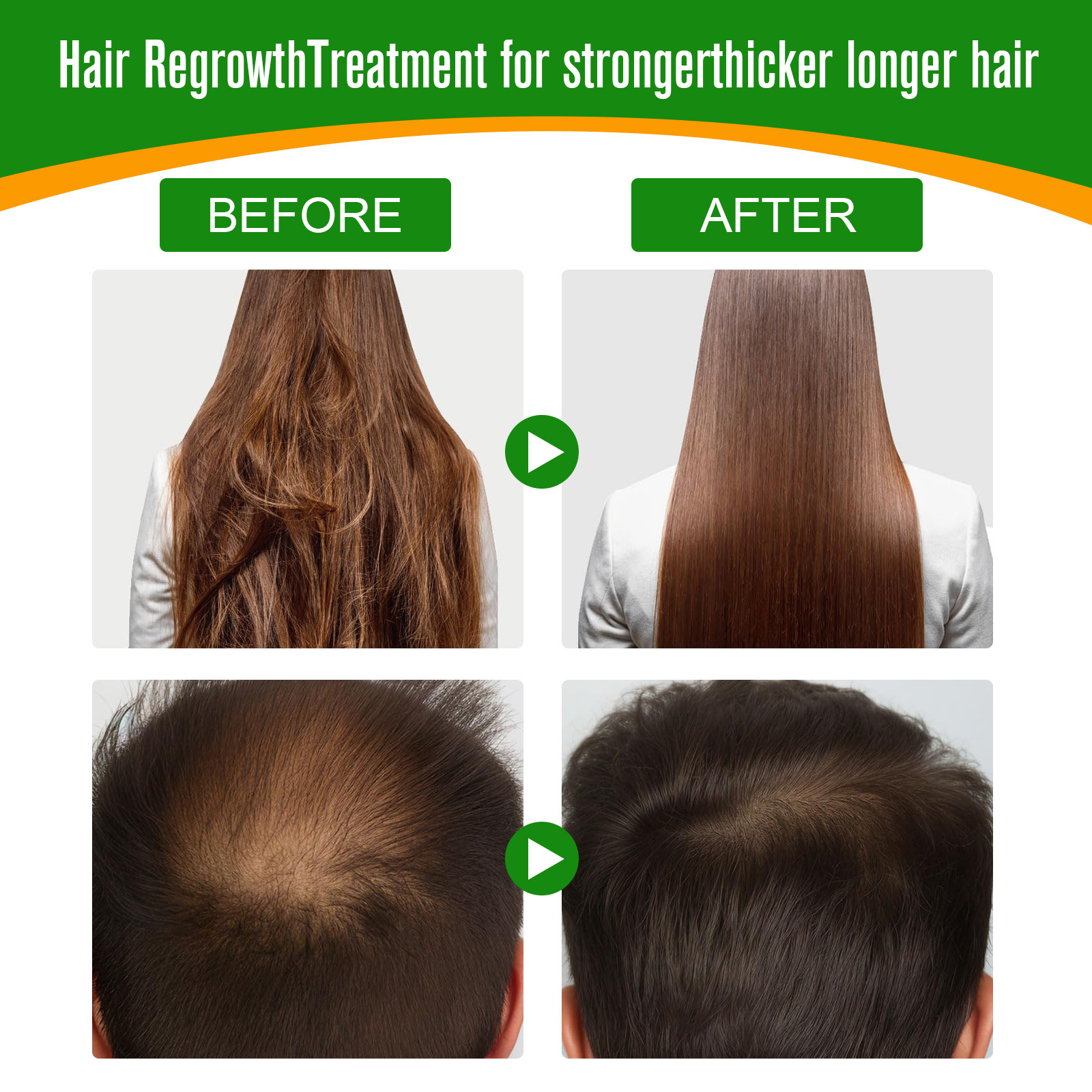 Manufacturers Wholesale Pure Natural Anti Loss Hair Regrowth Batana Oil Bulk Private Label Organic Batana Oil for Hair Growth