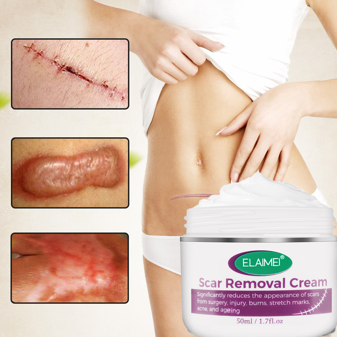 Dropshipping Aliver Scar Removal Cream For Old Scars Stretch Mark or Face Skin Repair Cream