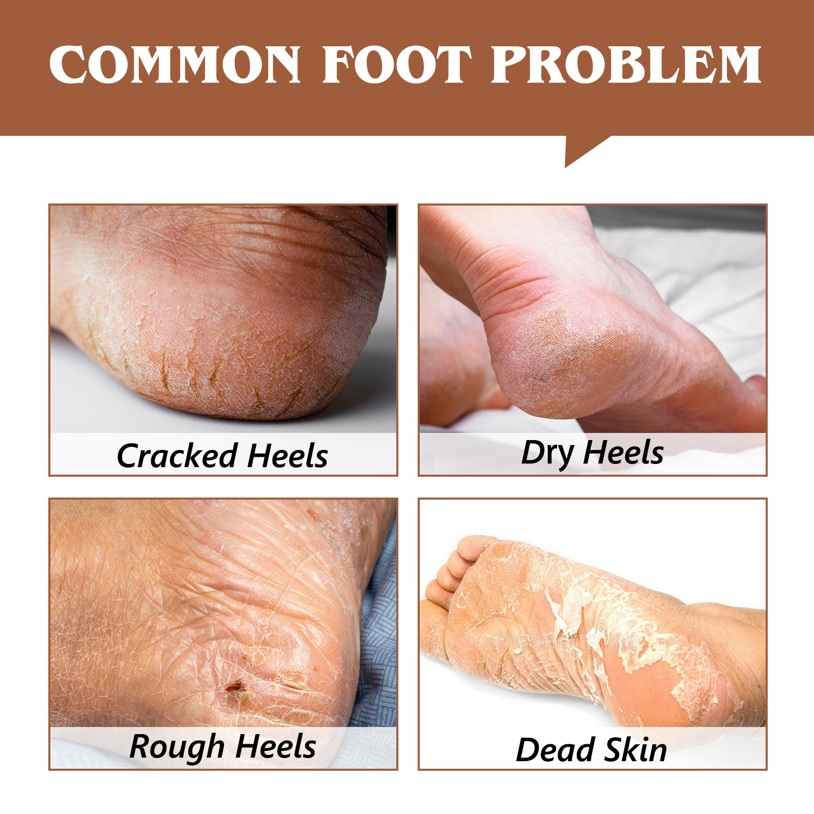 Dry Skin Rough Heels Cracked Heel Repair Balm Stick for Dry Cracked Feet Treatment with Shea Butter and Olive Oil