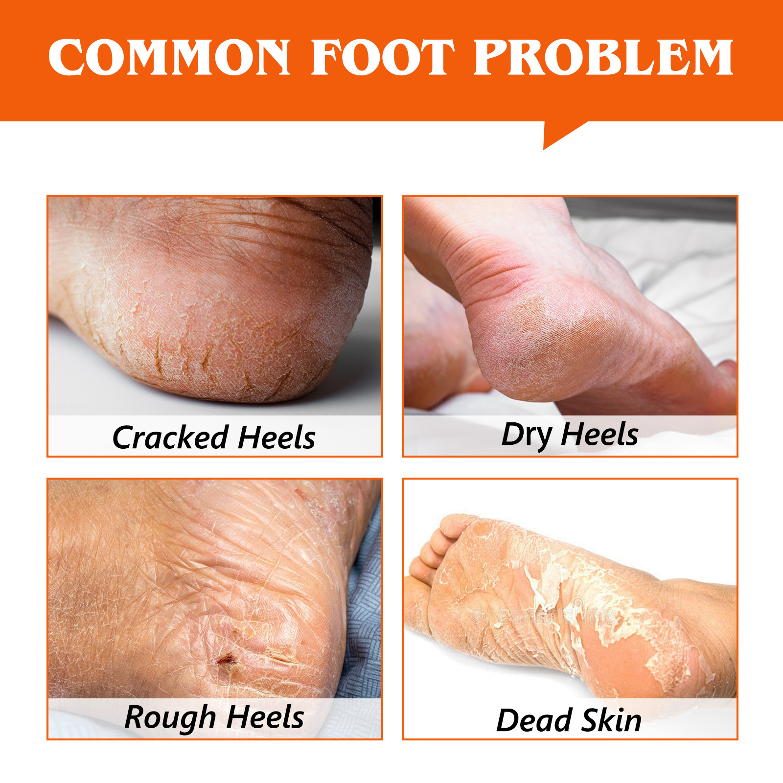 Professional Dry Cracked Feet Treatment Moisturizing Rolls Heel Repair Balm Stick to Rescues Cracked Feet for Skin So Soft