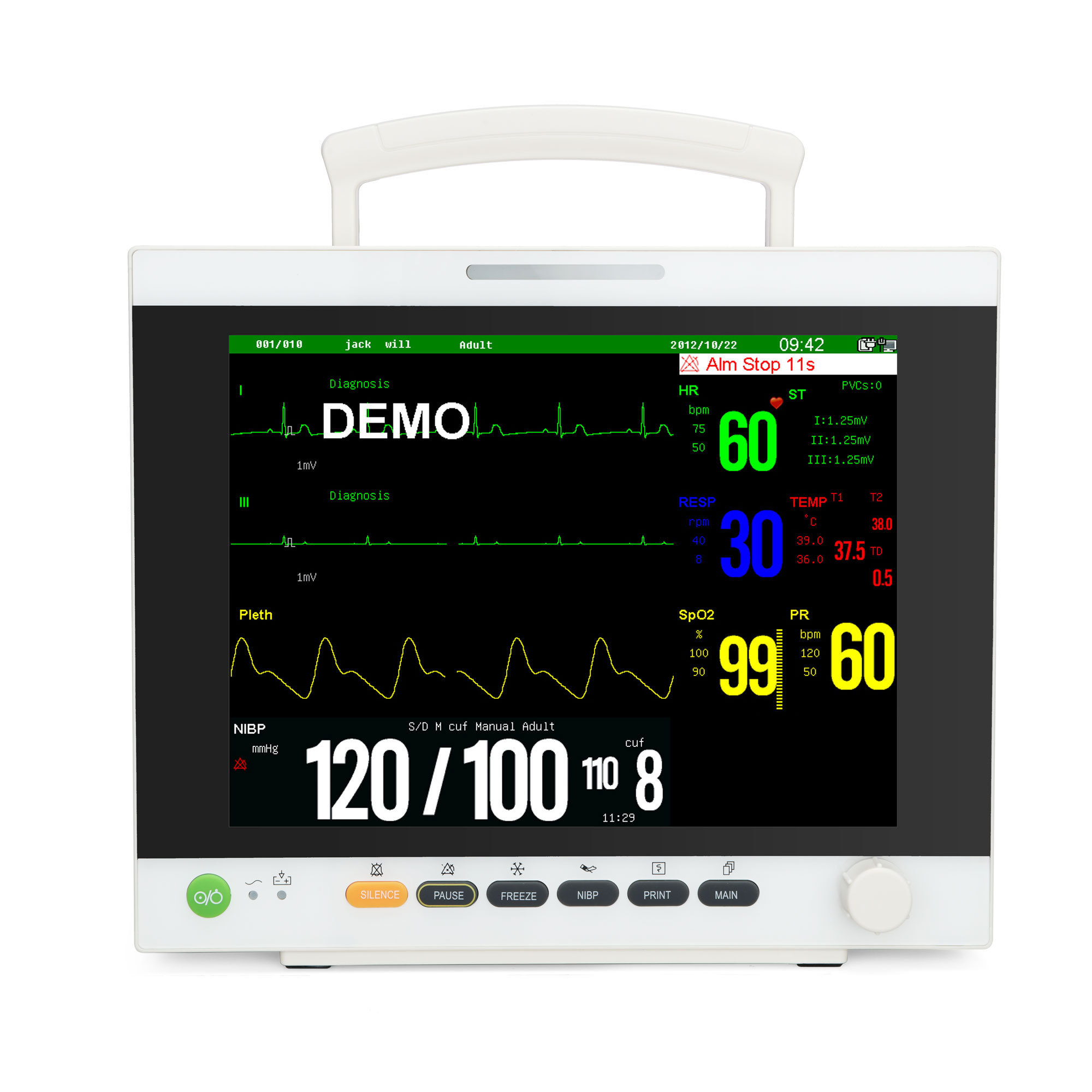 Professional Multi-parameter patient monitor model AM9000JA+ for Adult/ pediatric/ Neonate patients 12.1