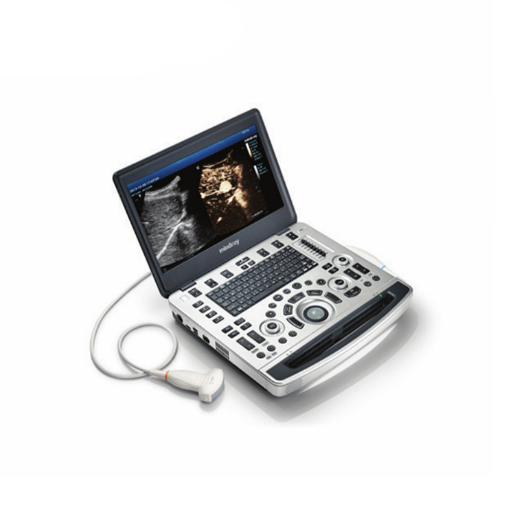 100% good feedback color doppler mindray ultrasound machine, mindray ultrasound M5 M6 M7 M9 price for sale