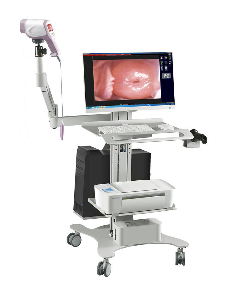 Trolley Obstetrics And Gynecology Video Colposcope Optical Digital Colposcope System For Gynecology