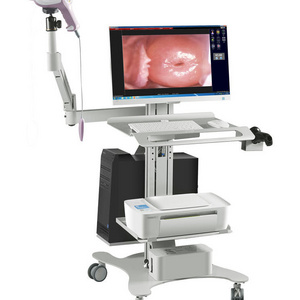 Trolley Obstetrics And Gynecology Video Colposcope Optical Digital Colposcope System For Gynecology