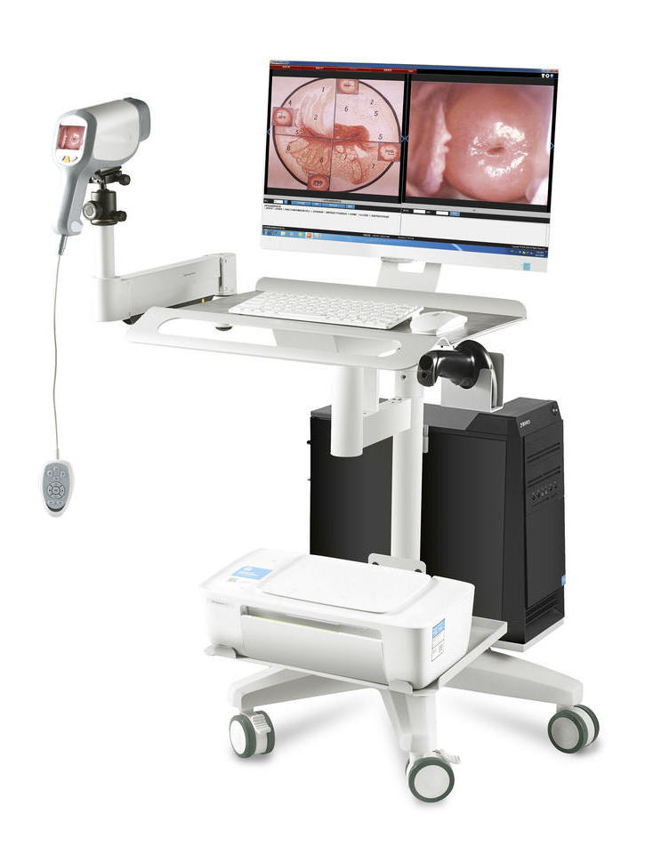 Trolley Obstetrics And Gynecology Video Colposcope Optical Digital Colposcope System For Gynecology