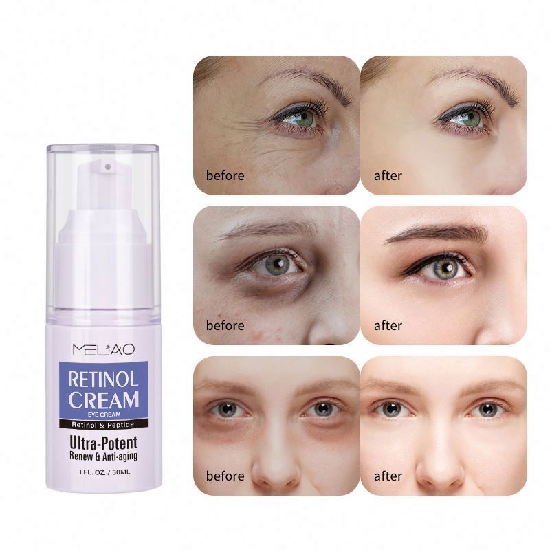 Best Anti-Wrinkle Whitening Beauty Health Retinol Eye Cream For Dark Circles