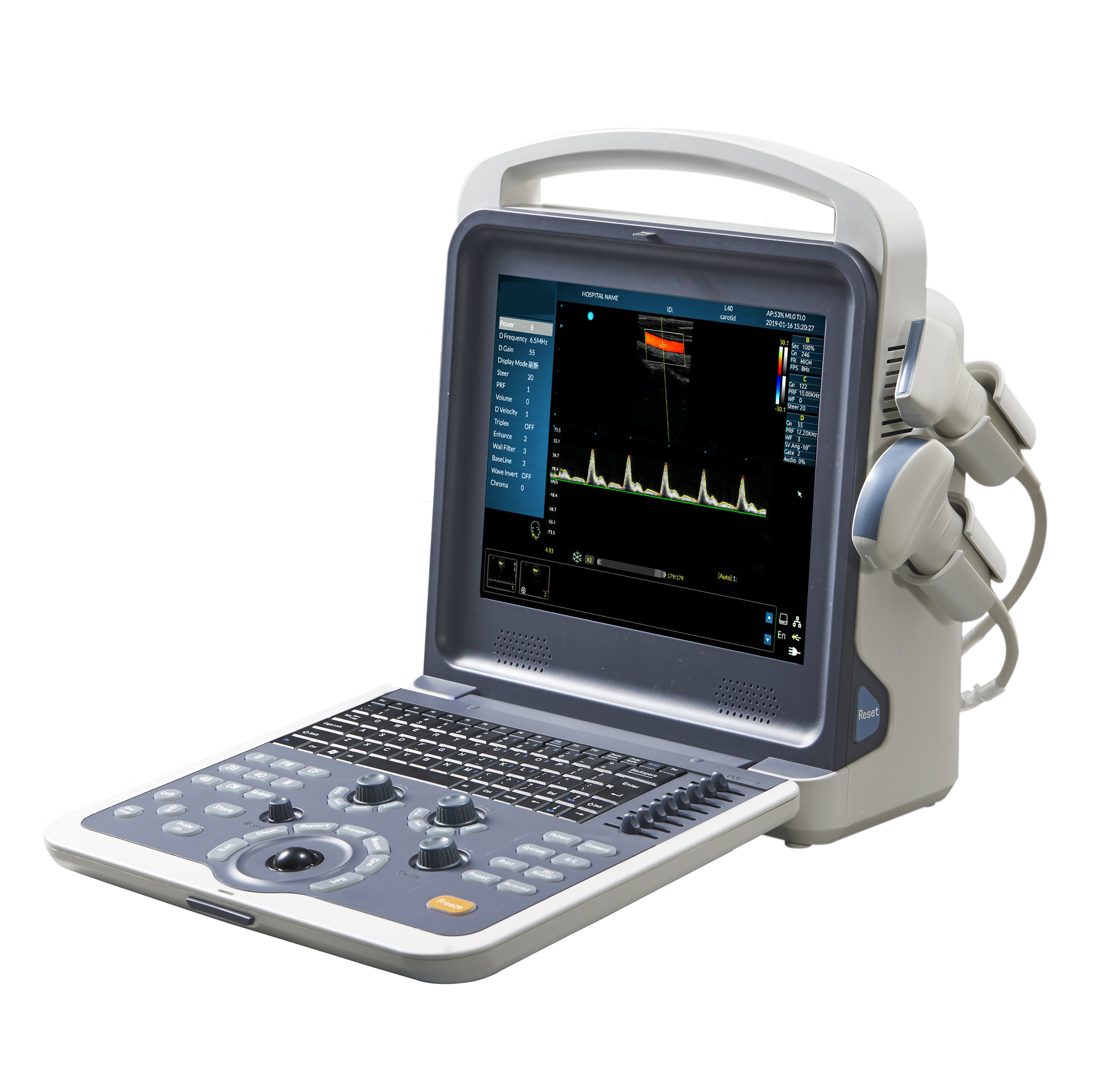 Echocardiography machine diagnostic laptop ultrasound  15 inch LED Monitor medical ultrasound machine