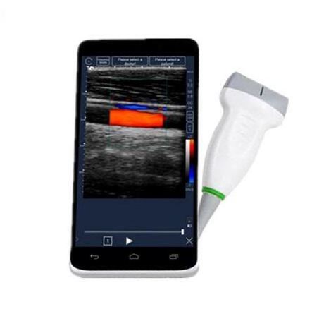 Phone mini portable pocket ultrasound machine price ultrasound scanner android cellphone ultrasound scanner