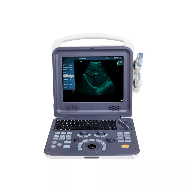 Echocardiography machine diagnostic laptop ultrasound  15 inch LED Monitor medical ultrasound machine